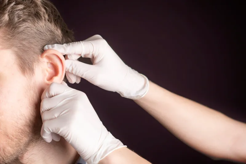 Kepçe kulak estetiği otoplasti, Prof. Dr. Esin Yalçınkaya